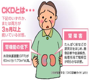 慢性腎臓病(CKD)とは